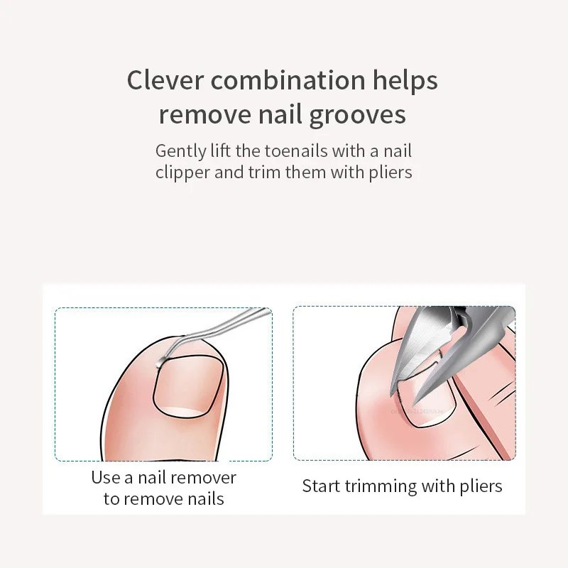 Toenail Clippers Dead Skin Remove Nail Ingrown Eagle Nose Nipper Cuticle Scissors Nail Cutter Paronychia Tools Pedicure Manicure