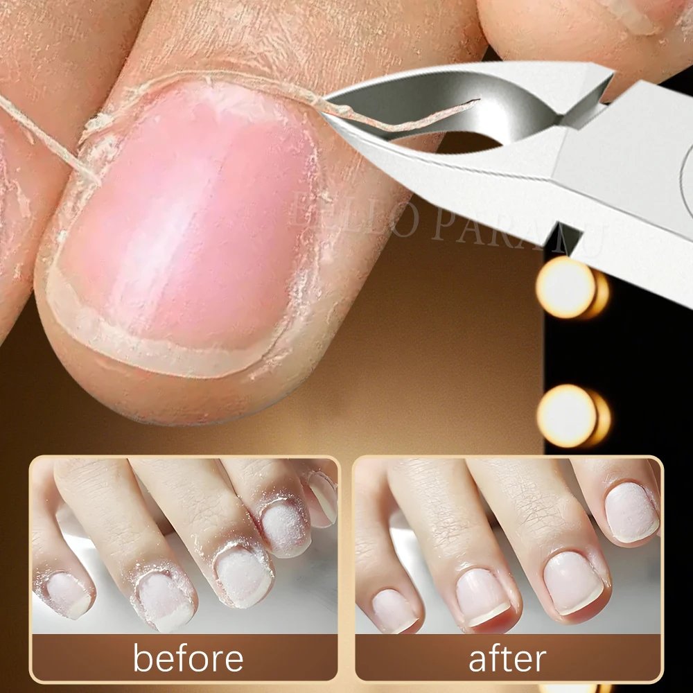 1Pcs Professional Cuticle Nippers Stainless Steel Sharp Blades Nail Cuticle Clippers Cutter Trimmer Manicure Tool - Image 3