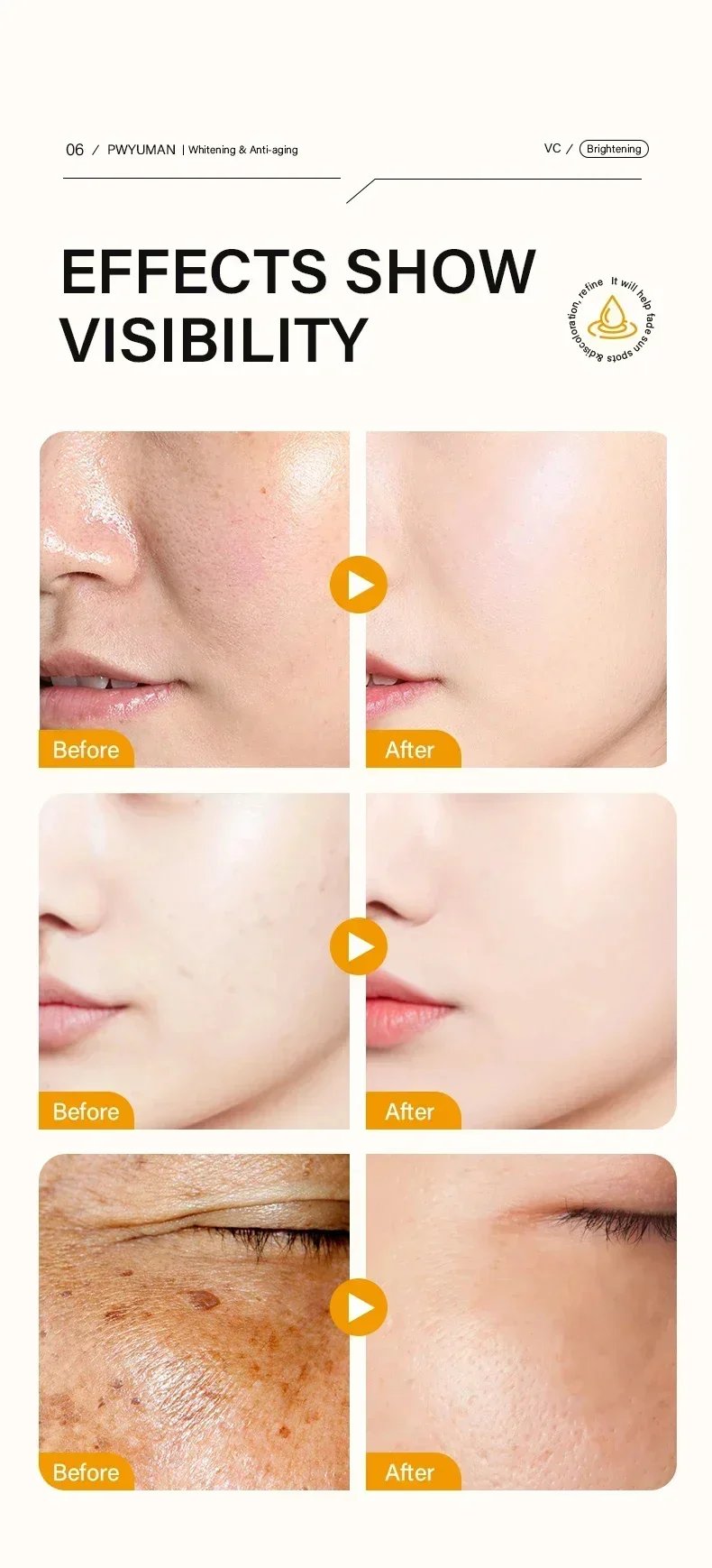 Powerful Dark Spots Remover Whitening Serum Face Freckle Melanin Correcting Anti Pigmentation Brighten Skin Beauty Care Products