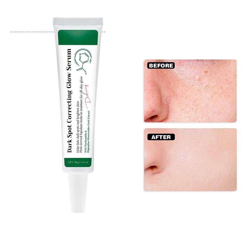 Dark Spot Correcting Glow Serum,Dullness,Acne,And Melanin Remover,Niacinamide Facial Skin Moisturizing Brightening Skincare