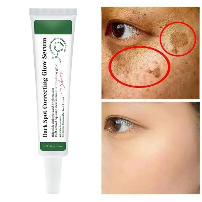 Dark Spot Correcting Glow Serum,Dullness,Acne,And Melanin Remover,Niacinamide Facial Skin Moisturizing Brightening Skincare