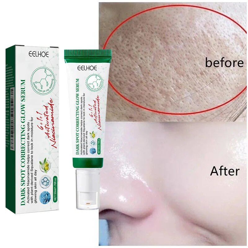 Dark Spot Correcting Glow Serum,Dullness,Acne,And Melanin Remover,Niacinamide Facial Skin Moisturizing Brightening Skincare
