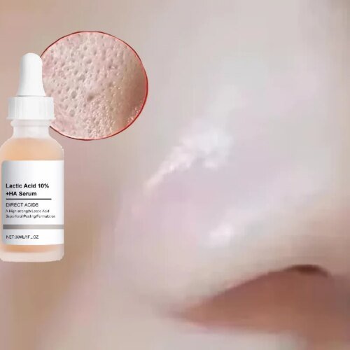 Large Pore essence Lactic Acid Facial Pore Shrinking Product Pore Firming and Smooth Korean Skin Care