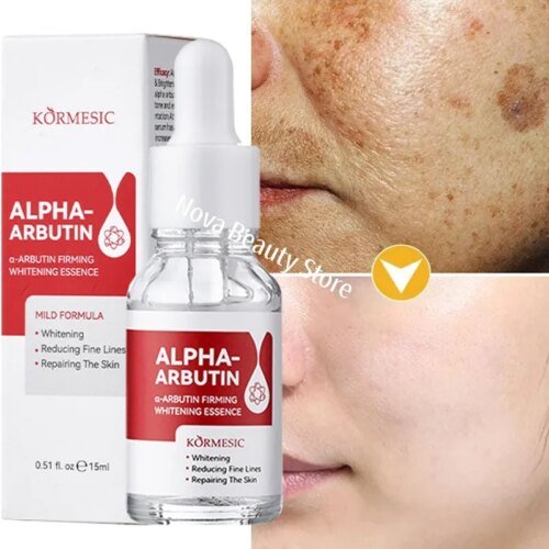 Dark Spots Remover Whitening Serum Face Freckle Melanin Correcting Reduce Fine Lines Brighten Essence Korean Beauty Skin Care